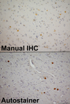 IHC